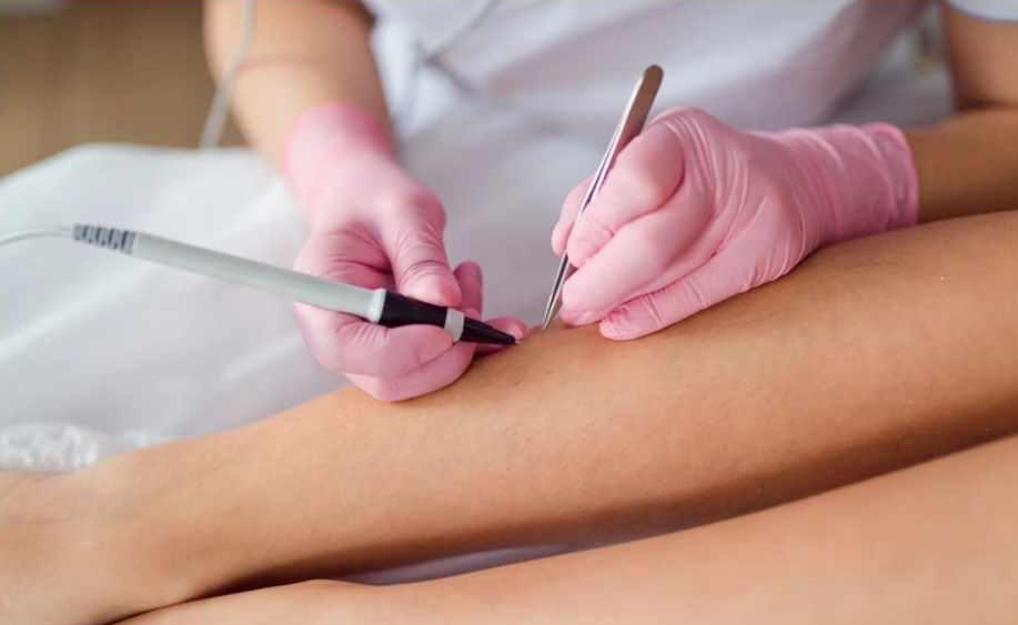 [zerkaloepil] Электроэпиляция в идеальном исполнении. Базовый курс (2025)