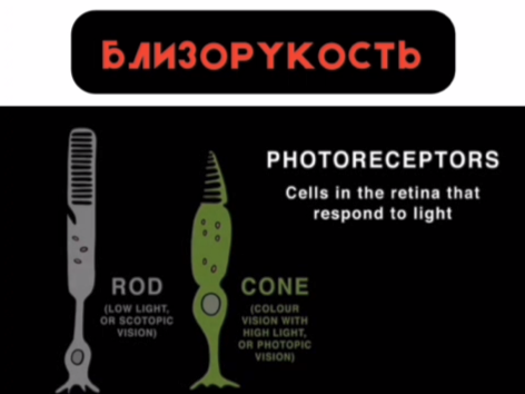 [Артур Мазаев] Близорукость с точки зрения холистического врача (2024)