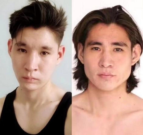 [Амир] Развитие нижней трети лица методом чьюинга (2023)