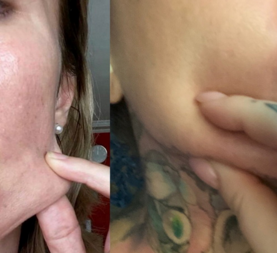 [Ярослава Науменко] Гормон роста – гормон жиросжигания и кожи без морщин (2025)