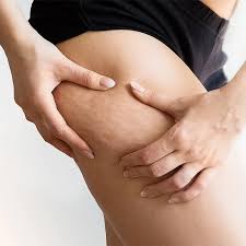 [AST Production] Скейпинг. Целлюлит