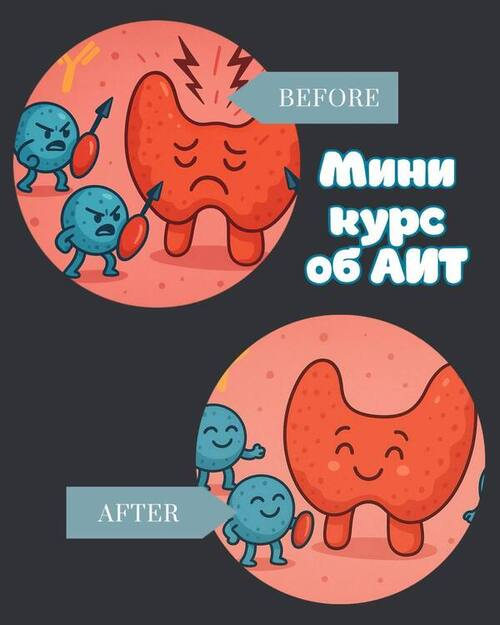 [Лариса Чумак] [endo_doc_] Мини курс по АИТ (2025)